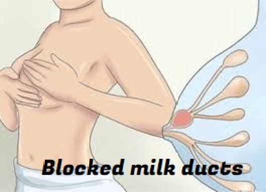 blocked-milk-ducts